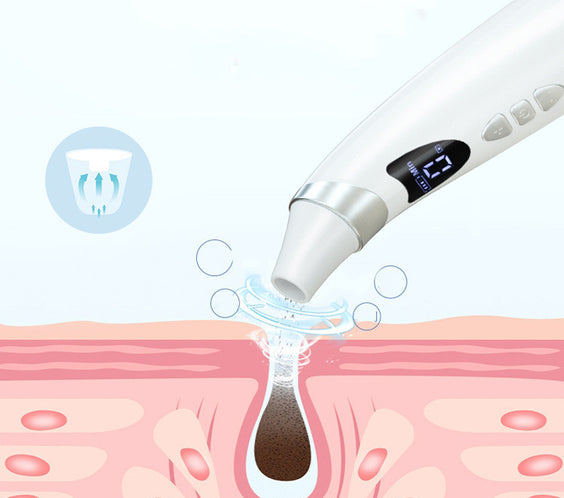 Electric Visual Blackhead Suction Instrument Household Cleansing Pore Cleaner For Skin Equipment Skin Care Tool