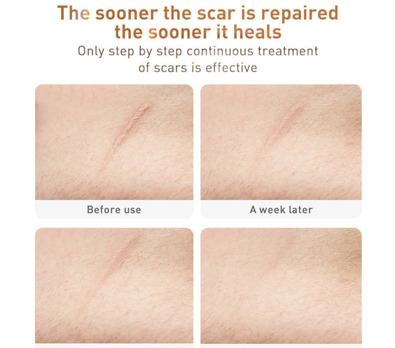 Traditional Chinese Medicine Scar Removal Cream Care Cream Skin Care Products